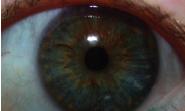 Eye2