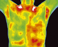 Thermography shot 1a