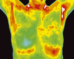 Thermography shot 1b