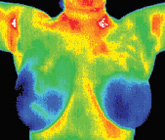 Thermography shot 2