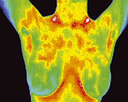 Thermography shot 3a