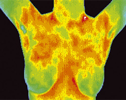Thermography shot 3b