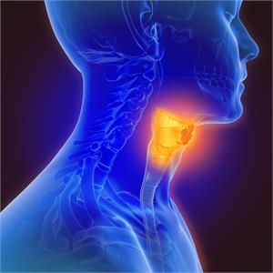 Throat Cancer