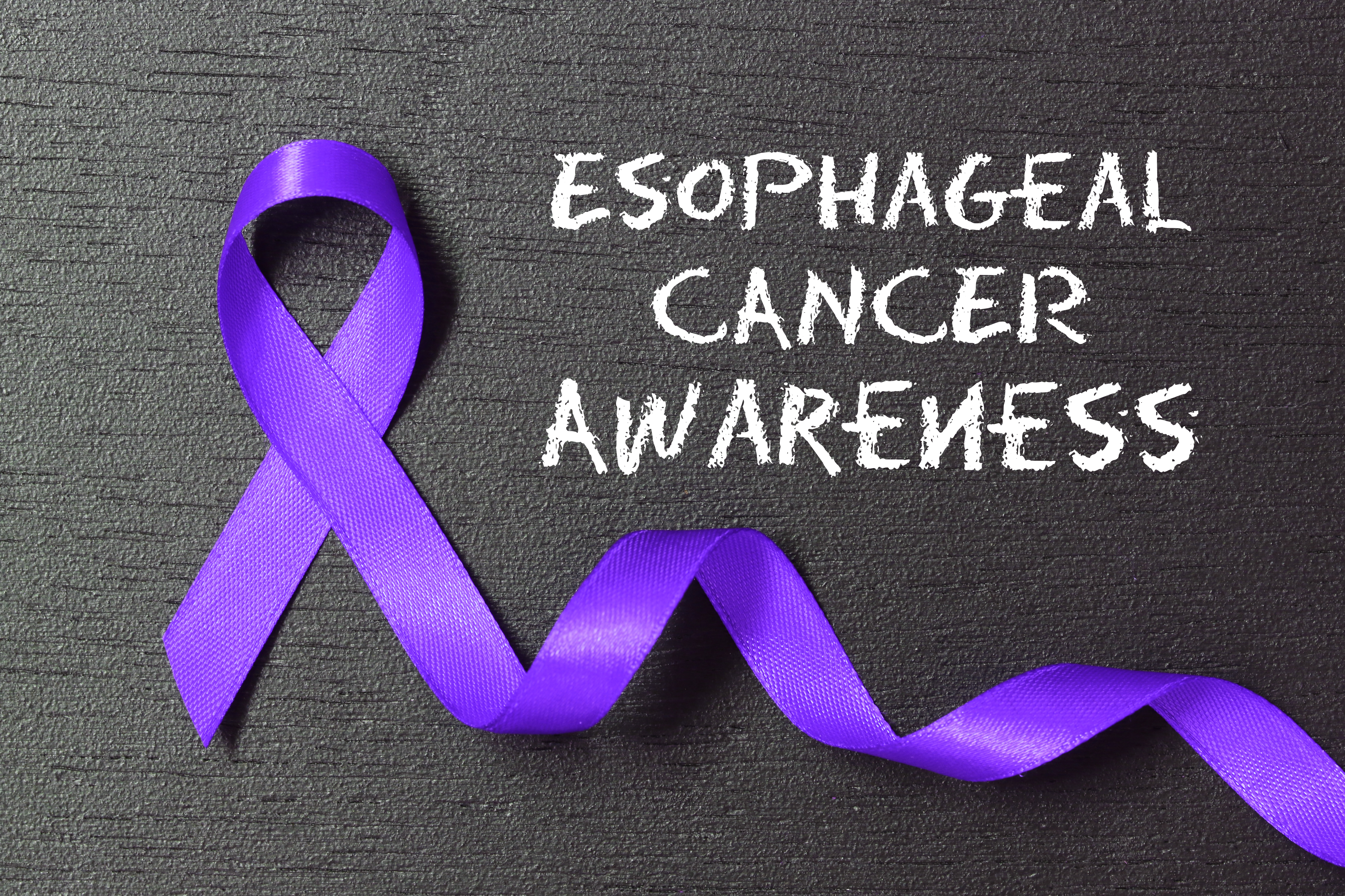 Oesophageal Cancer