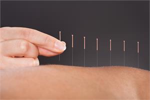 TCM, Acupuncture and Cancer Treatment