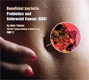 The role of gut bacteria in colorectal cancer