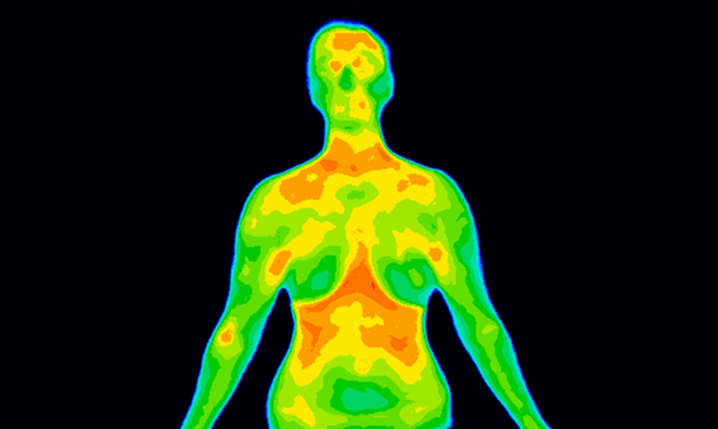 Thermal Imaging, or, Thermography