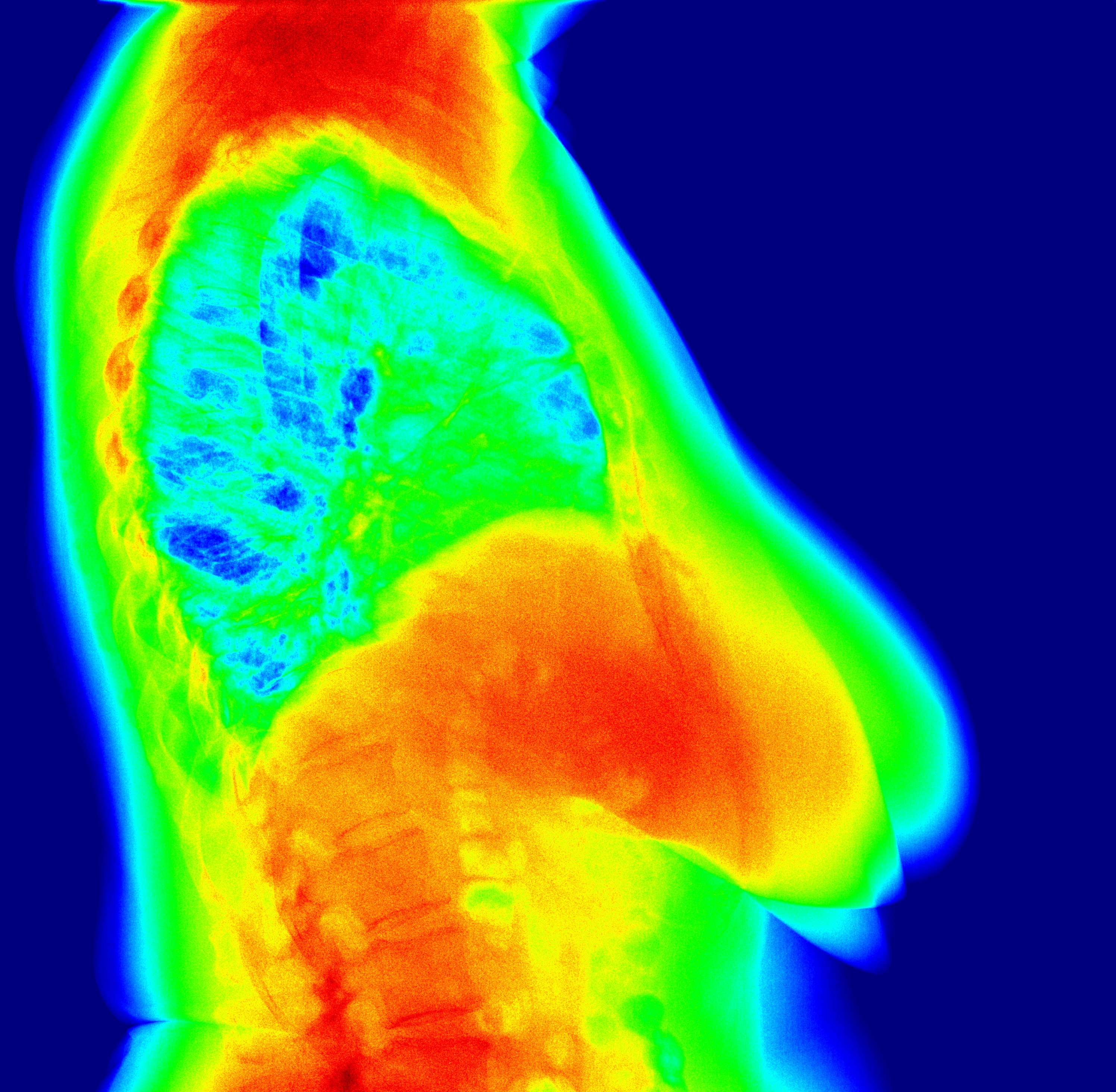 thermal imaging
