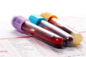 Blood test could soon warn of breast cancer risk