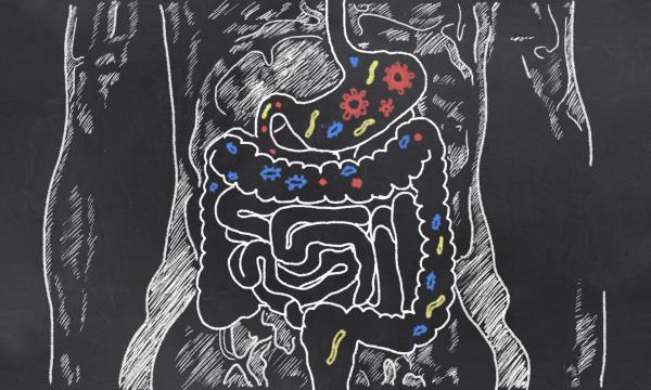 All cancer begins in the gut