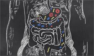 All cancer begins in the gut