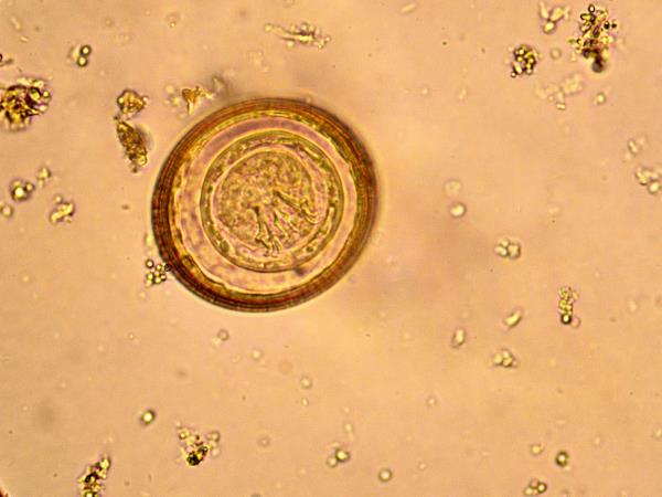 mebendazol pinworm