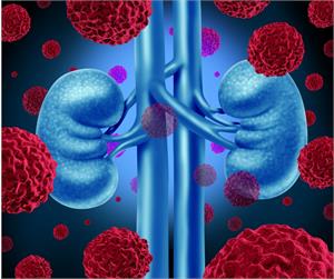 Alternative Kidney Cancer Treatments