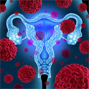 Cancer of the womb - Tamoxifen one possible cause