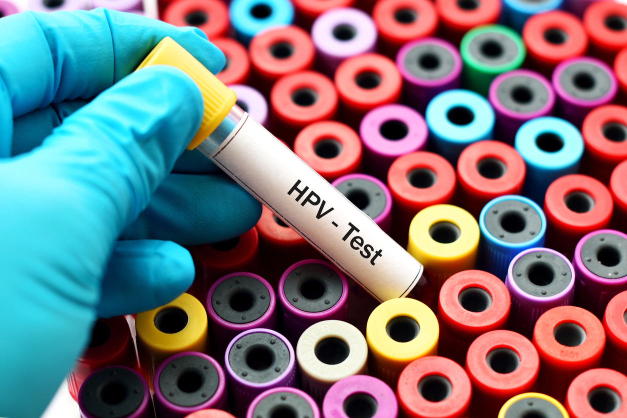 More accurate test for HPV launched